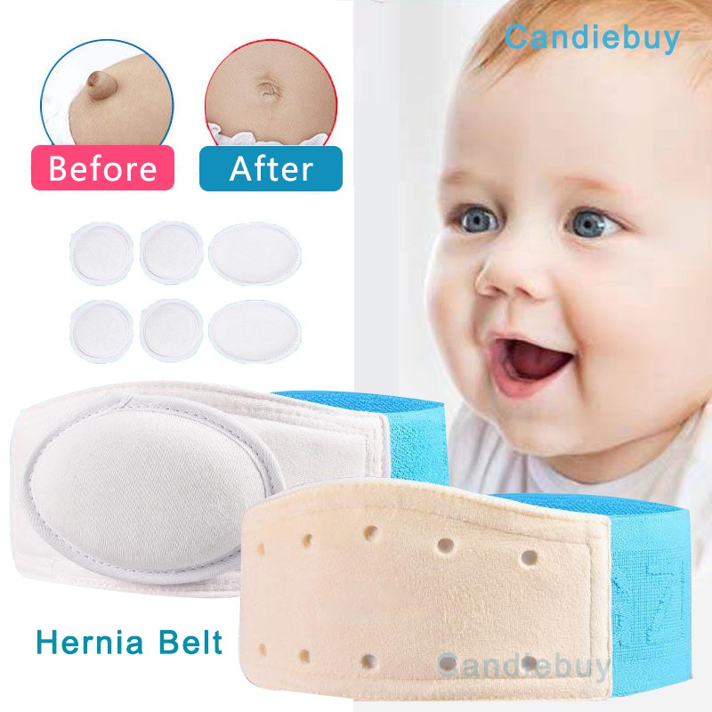 Hernia Belt For Babies, 2-Piece Hernia Belt Treatment For Hernia For  Children Umbilical Hernia Belt For Newborns Infant Newborn Belt(Rosa)