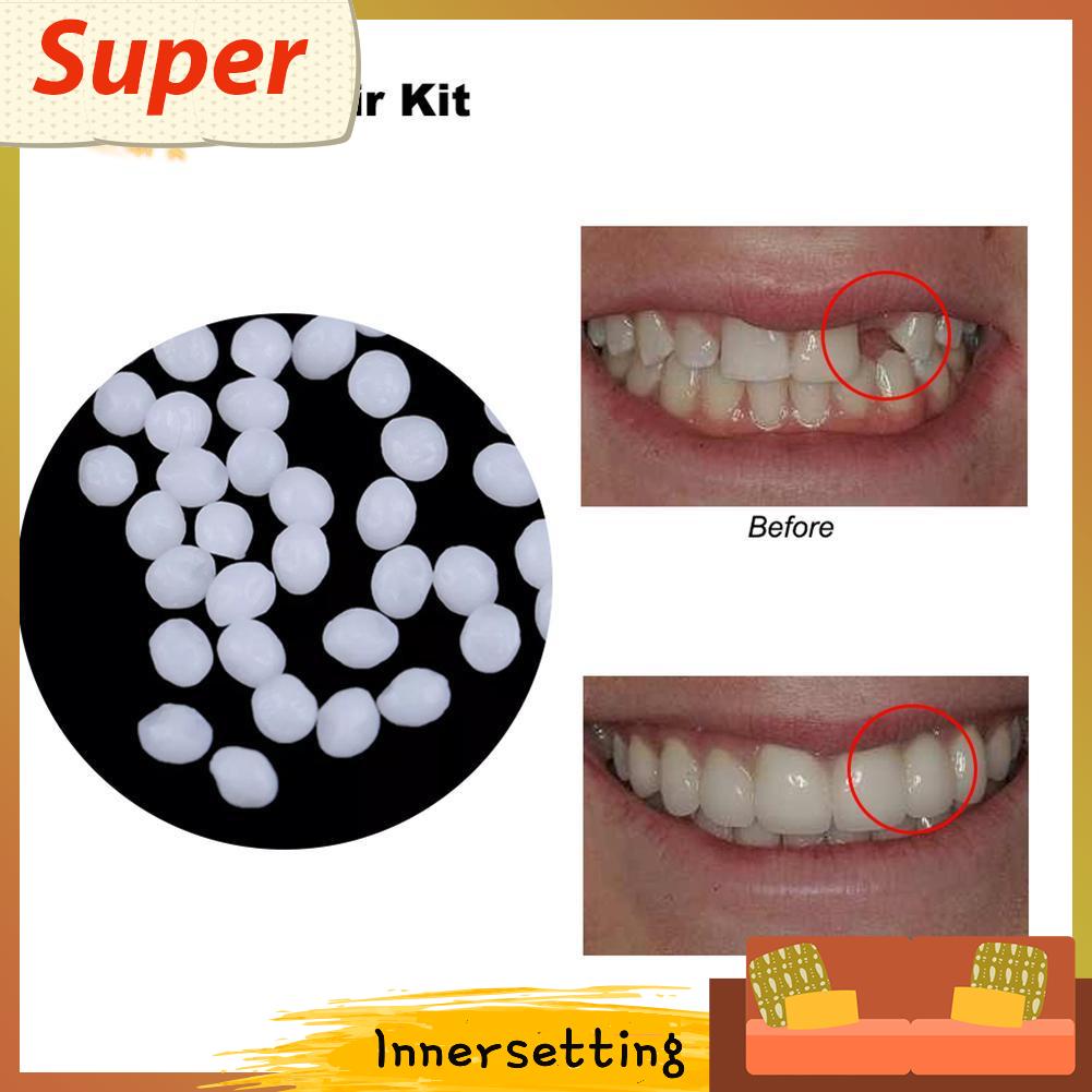 Glue for store tooth