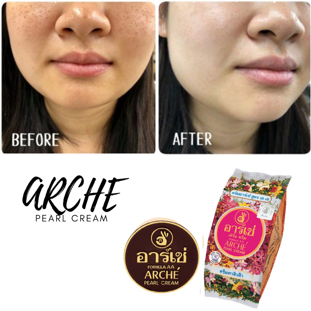 ARCHE Cream Pure Pearl Whitening Krim Muka Pencerah Mutiara