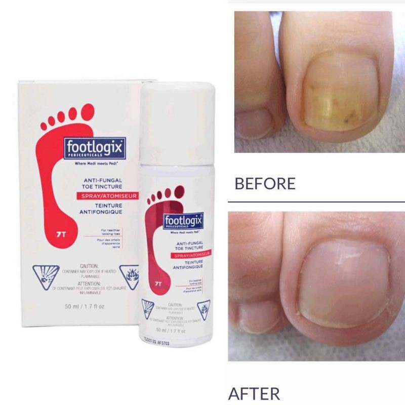 FootLogix Nail Tincture