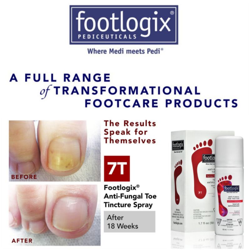 FootLogix Nail Tincture