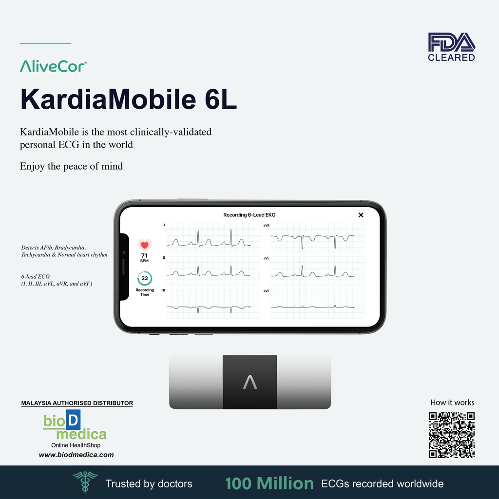 AliveCor KardiaMobile