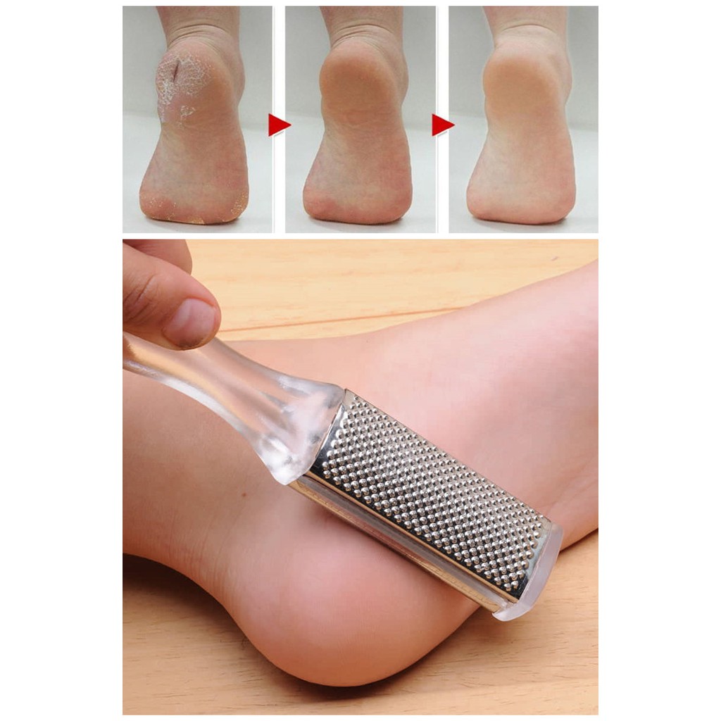 Foot File Pedicure Callus Remover Hard Dead Skin Foot Dead Skin