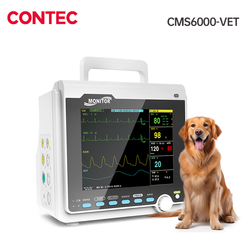 CONTEC CMS1000 Handheld Patient Monitor ICU Vital Signs Monitor 6 Para