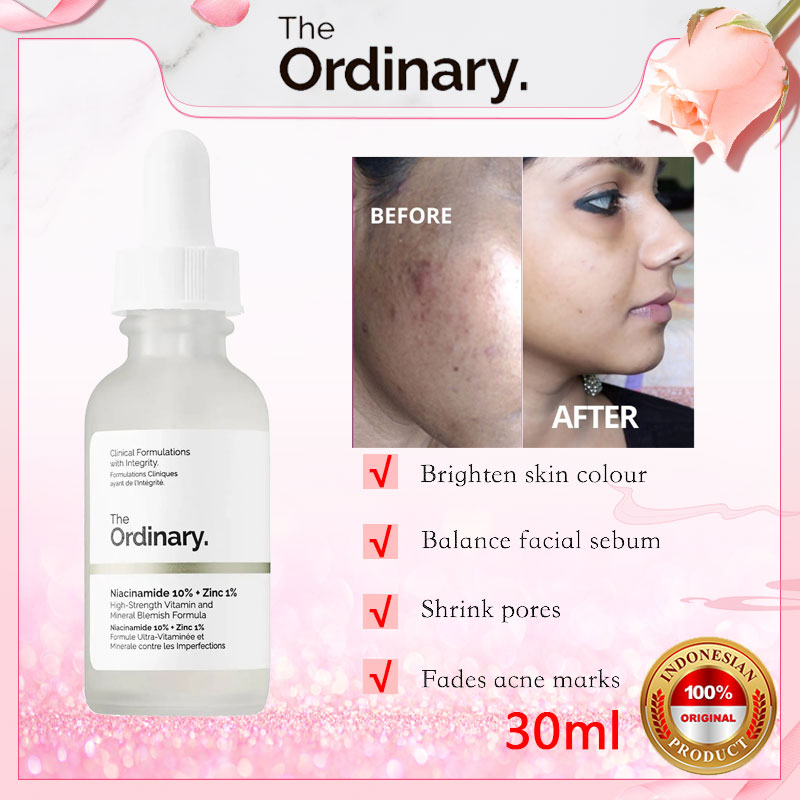 The Ordinary Niacinamide 10% + Zinc 1% 30ml High-Strength Vitamin andMineral Blemish FormulaBe（applicable All Skin Type） | Shopee Malaysia