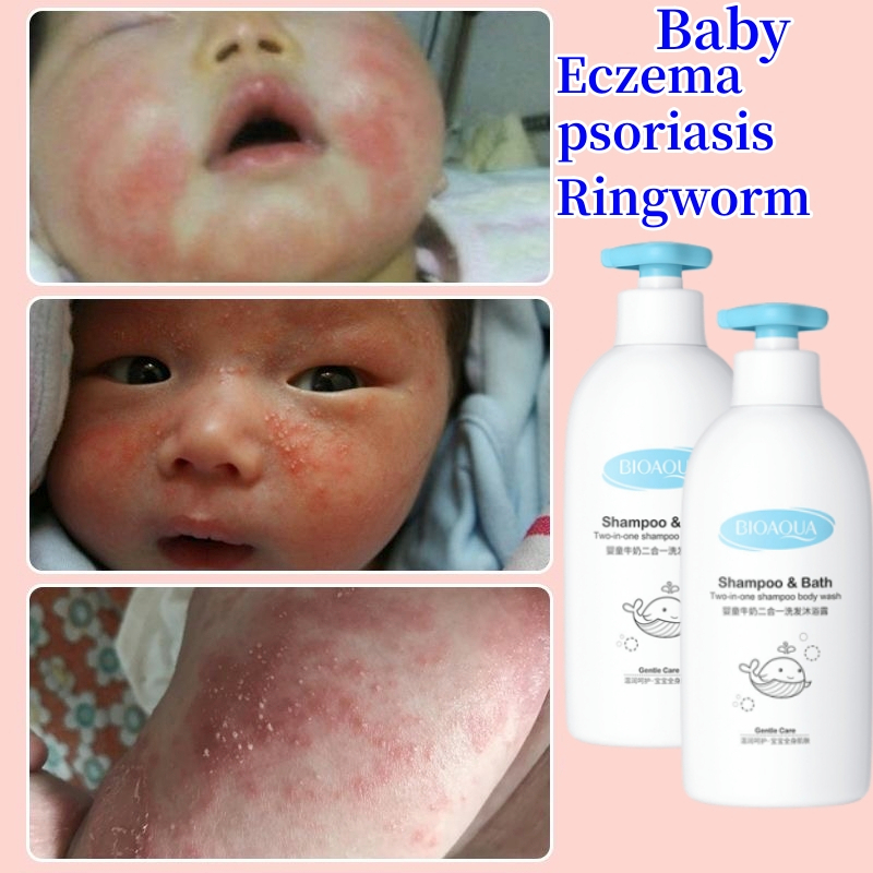 Children's best sale eczema shampoo